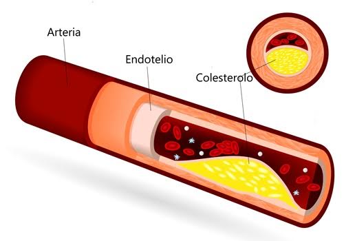 In cosa consiste l’intervento di by-pass aorto-coronarico?